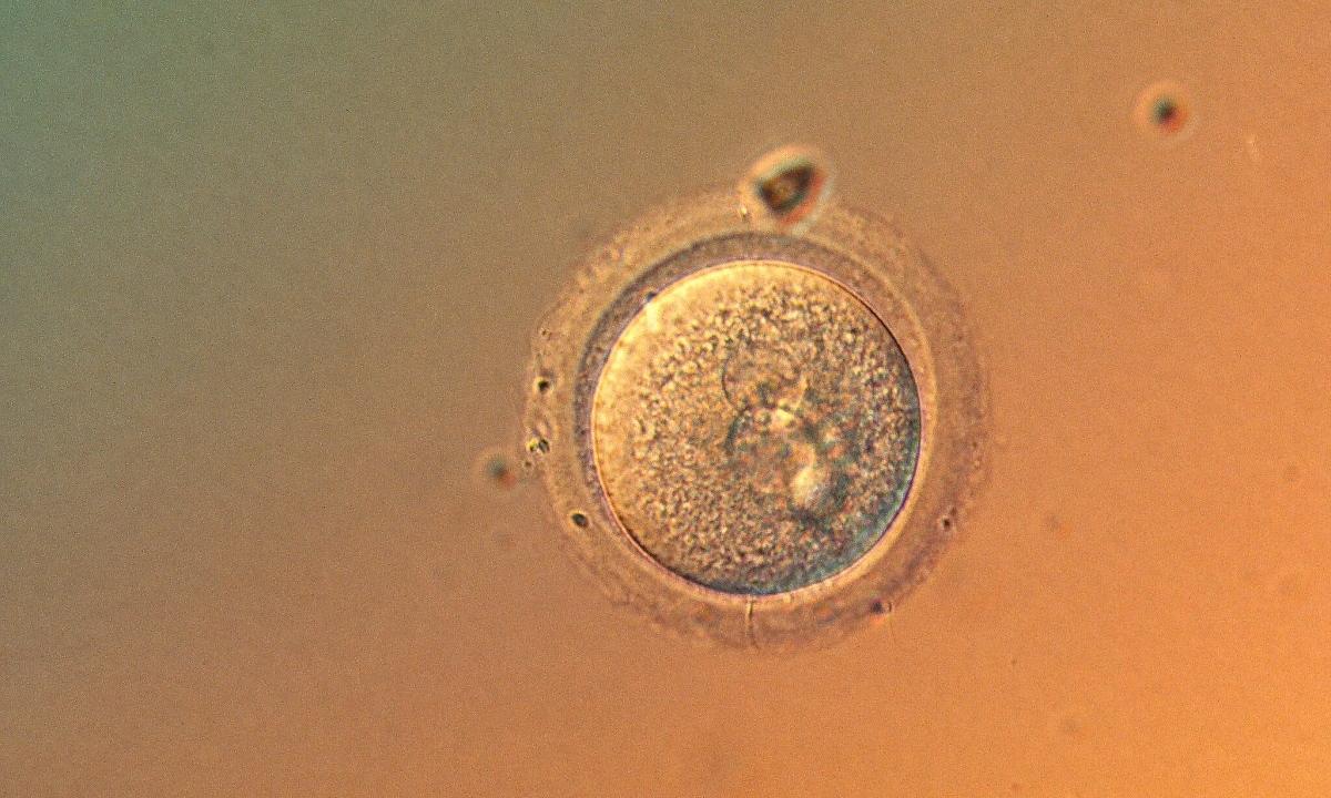 Lần đầu chỉnh sửa chính xác gene phôi người