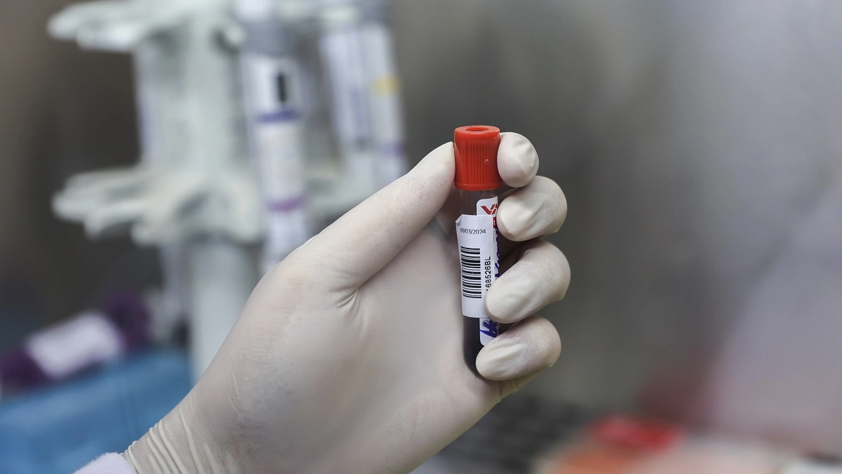 28 học sinh ngộ độc do nhiễm khuẩn Salmonella từ món trứng cuộn