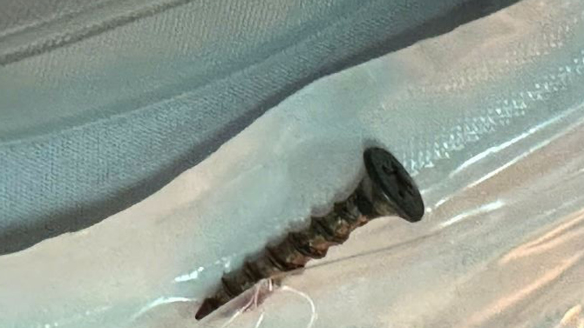 Chiếc đinh vít dài 4 cm trong đường thở bé trai